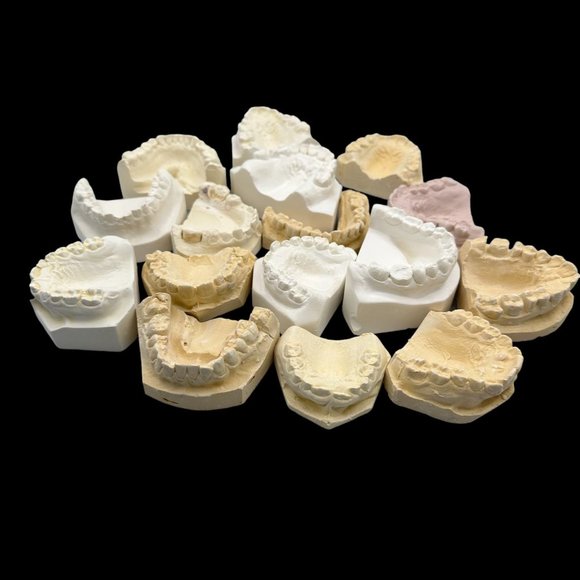 Vintage Plaster Dental Mold - Teeth Tooth Mold - Creepy Oddity - Dental Oddities - Picture 12 of 16